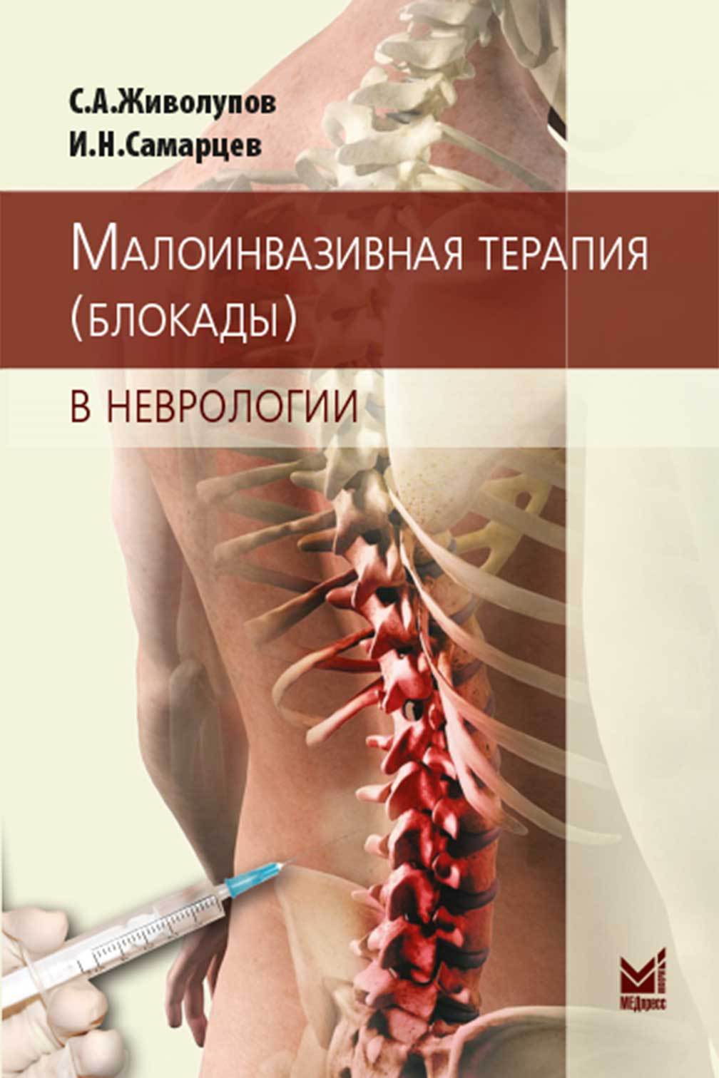 Анестезиология и реаниматология : Малоинвазивная терапия (блокады) в  неврологии. Монография